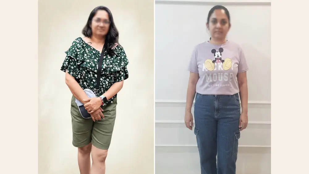 Transformation photo of Sushma, shared with permission.